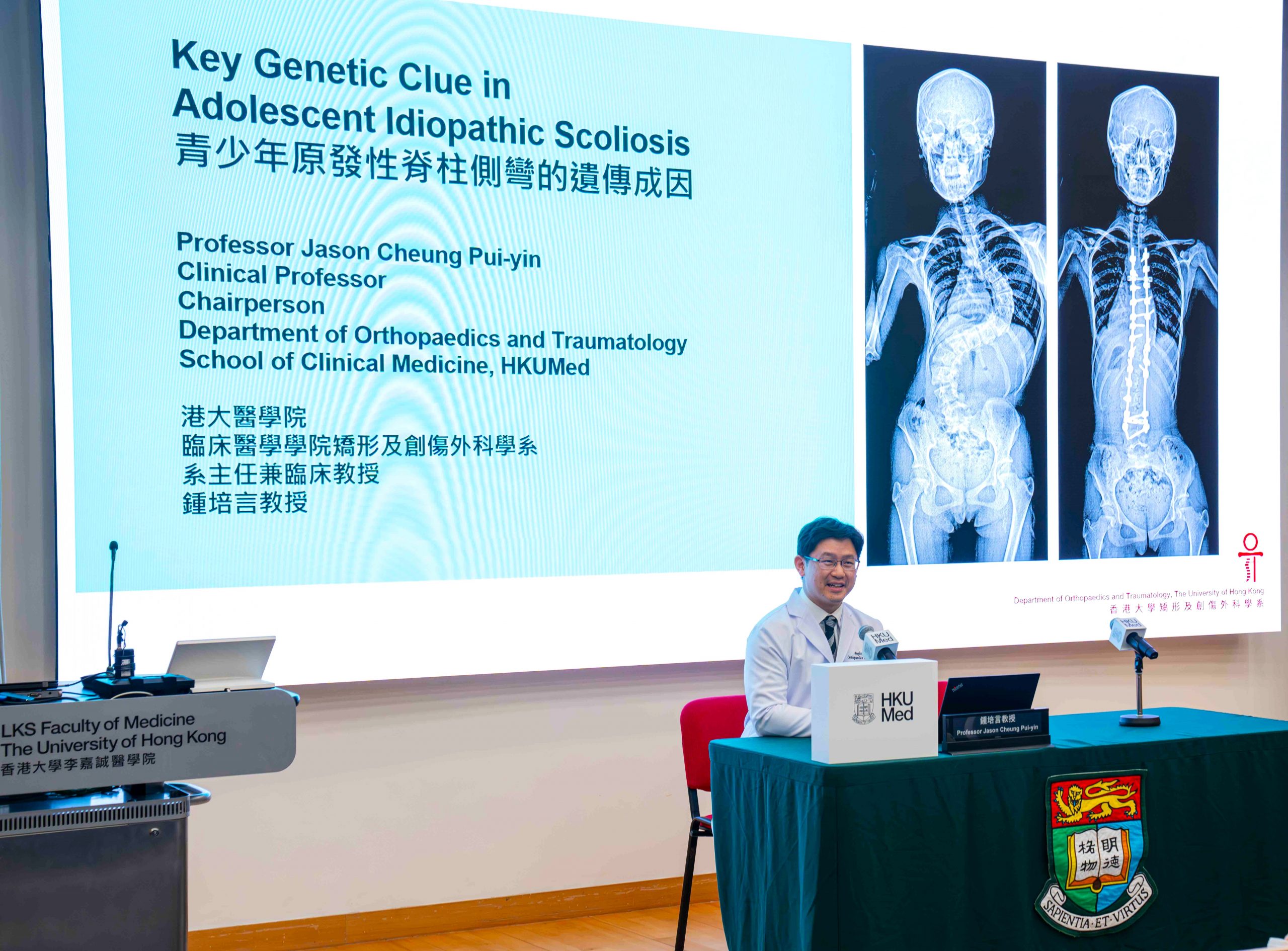 HKUMed researchers uncover key genetic clue in adolescent idiopathic scoliosis (AIS)港大醫學院發現青少年原發性脊柱側彎(AIS)患者的遺傳成因