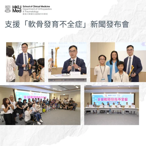 支援「軟骨發育不全症」新聞發布會
