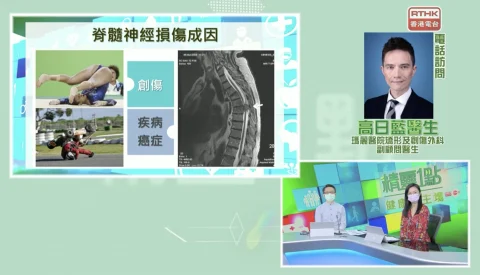 【短片】精靈一點：脊髓損傷復康團隊