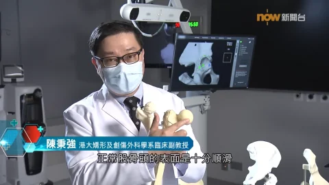 【杏林在線】機械臂輔助全髖關節置換手術