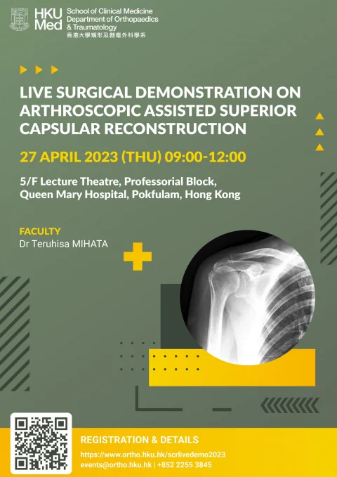 Live Surgical Demonstration on Arthroscopic Assisted Superior Capsular Reconstruction