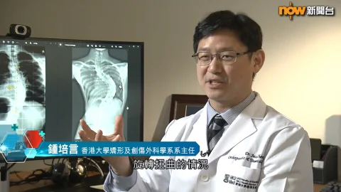 Scoliosis