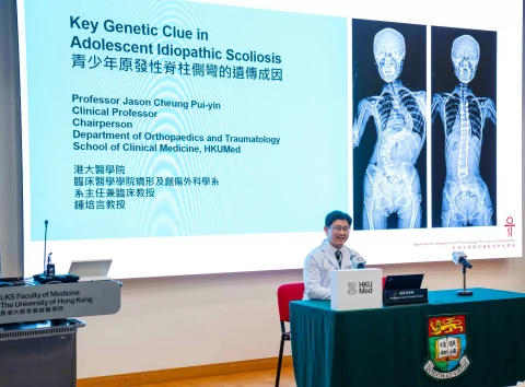 HKUMed researchers uncover key genetic clue in adolescent idiopathic scoliosis (AIS)港大醫學院發現青少年原發性脊柱側彎(AIS)患者的遺傳成因