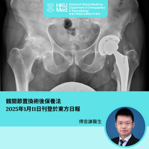 髖關節置換術後保養法
